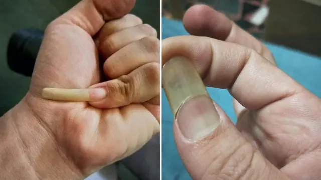 公公指甲超長卻不剪!媳婦崩潰「到底留著要幹嘛?」 專業網友給出解釋「不是為了挖鼻孔」