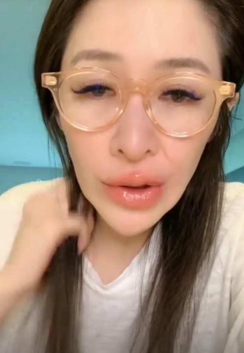健康亮紅燈！45歲台灣天后「雙頰凹陷暴瘦」粉絲認不出　虛弱嘆「還要再做手術」：過得很辛苦