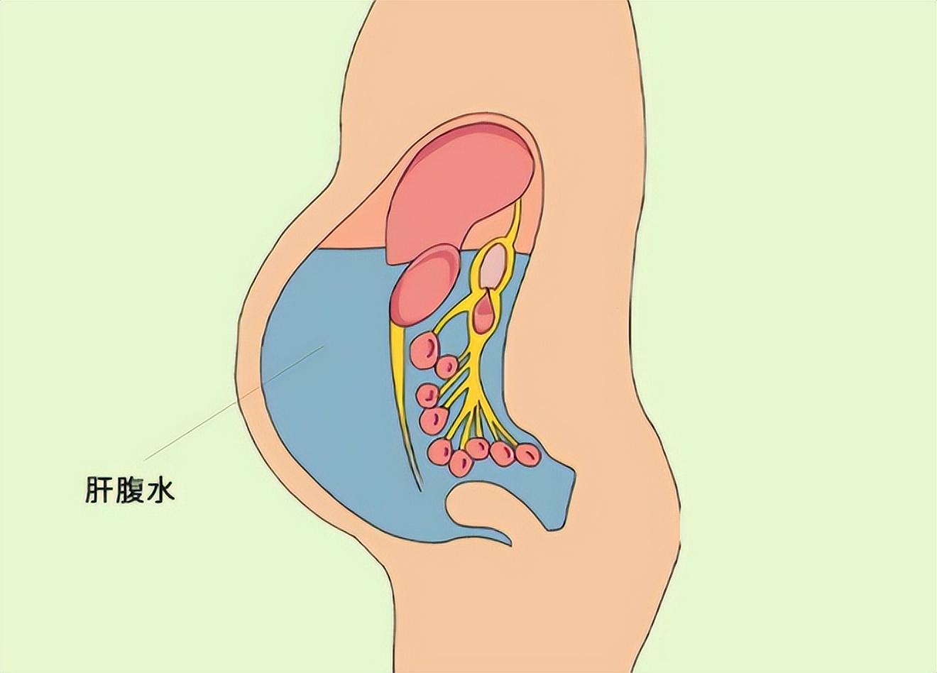 女子懷胎12月未生！老公一看「嚇逃走了」　醫生搖頭「被留在這等死」