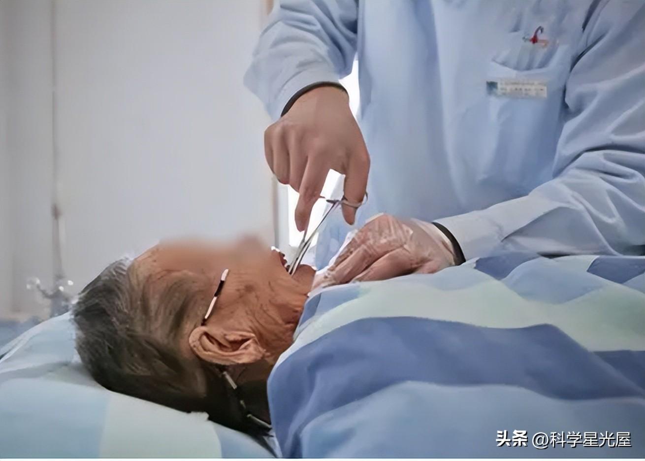 皮膚整片潰爛！71歲母親骨癌晚期「疼得一心求解脫」　女兒強行餵飯「哭求別咽氣」掀兩派網友論戰