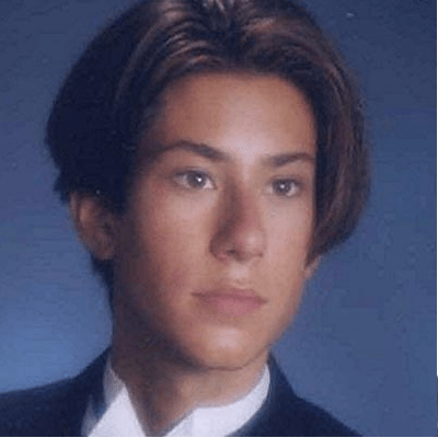 變身人間肯尼!男子著迷醫美「17歲就開始整形」動刀上千次 還曾請醫生幫他「在背上裝翅膀」
