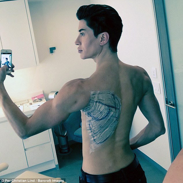 變身人間肯尼!男子著迷醫美「17歲就開始整形」動刀上千次 還曾請醫生幫他「在背上裝翅膀」