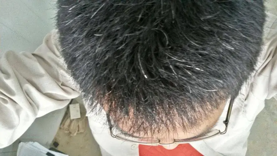 經常染髮「容易致癌」？醫生提醒：染前做到「這4點」就不用擔心