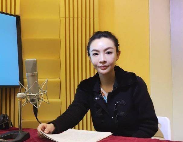 因整容丟掉前程！美女主持人「臉部僵硬、不自然」遭拒看　女星悲吐「無戲可拍」素顏照曝光