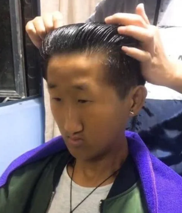 五官長超擠！他靠「超小眼睛」爆紅　下定決心「去動雙眼皮手術」成果網看呆：有差嗎