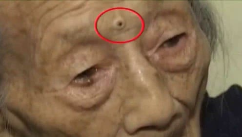 點掉太可惜！身上「3處有痣」是菩薩轉世　今生得神佛保佑「財運官運旺不停」