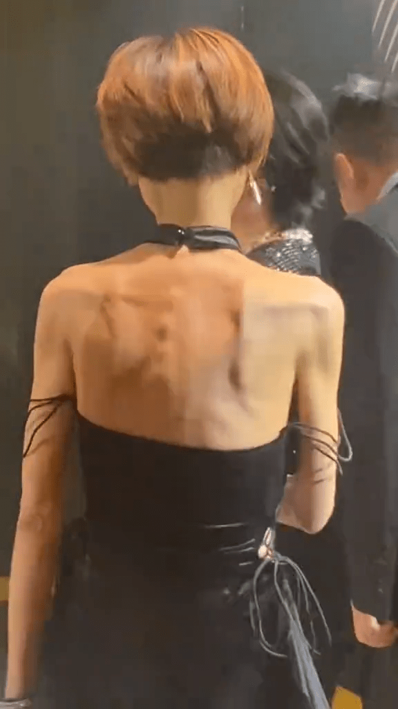 曾是性感女神！58歲資深女星罕露面「竟瘦成皮包骨」　一個轉身「背面讓全場嚇傻」：生病了嗎？