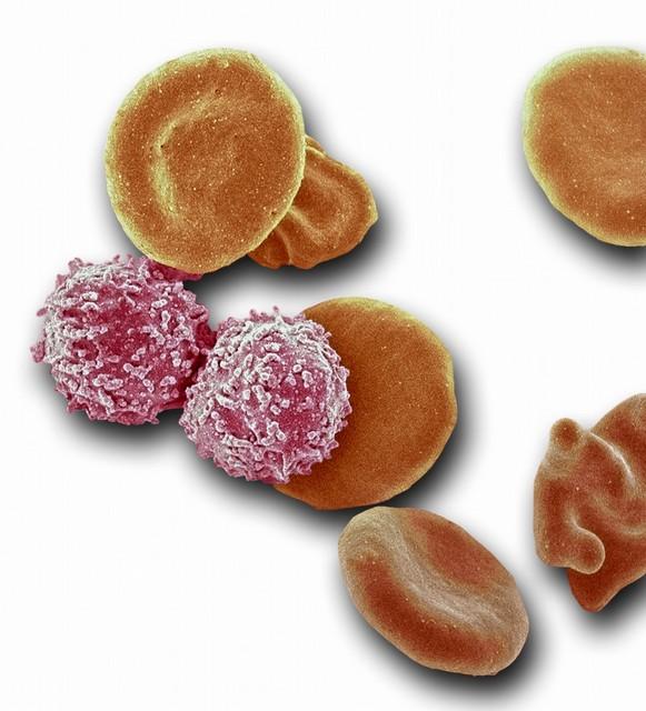 「4種早餐」是傷肝王！每一口都像用「鋼絲球刮肝」，很多人卻每天都吃：快停止