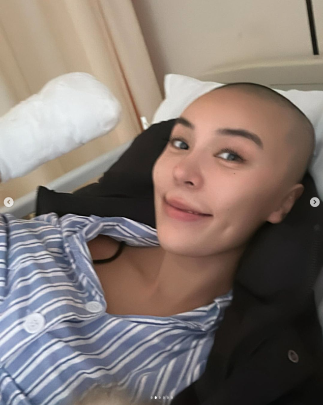 36歲女星截肢！熱愛戶外運動驚曝「我失去了我的左手」　勇敢曬手術照「成為一個半機器人」網友全看哭