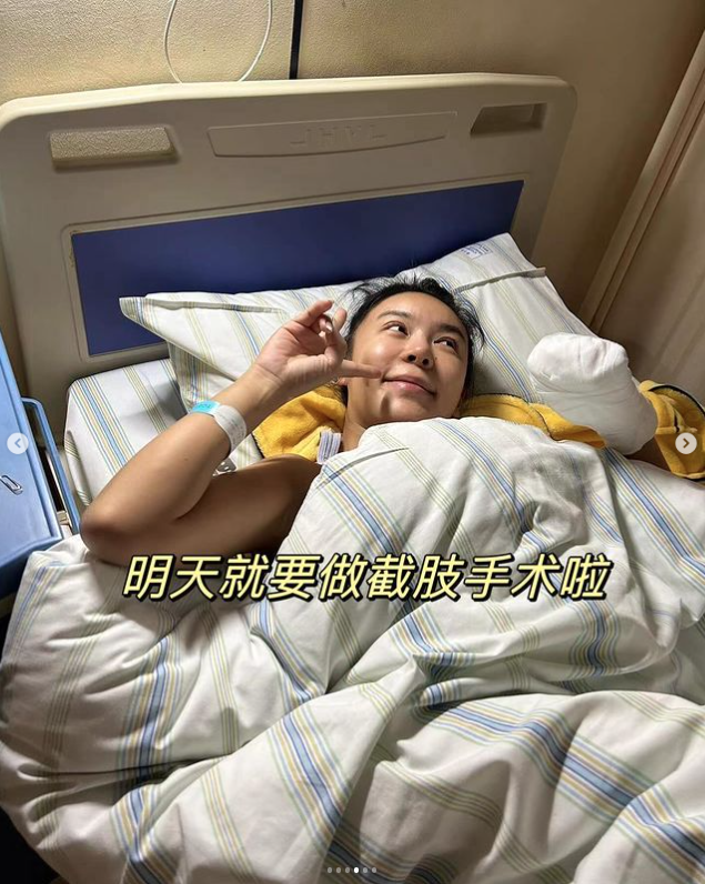 36歲女星截肢！熱愛戶外運動驚曝「我失去了我的左手」　勇敢曬手術照「成為一個半機器人」網友全看哭