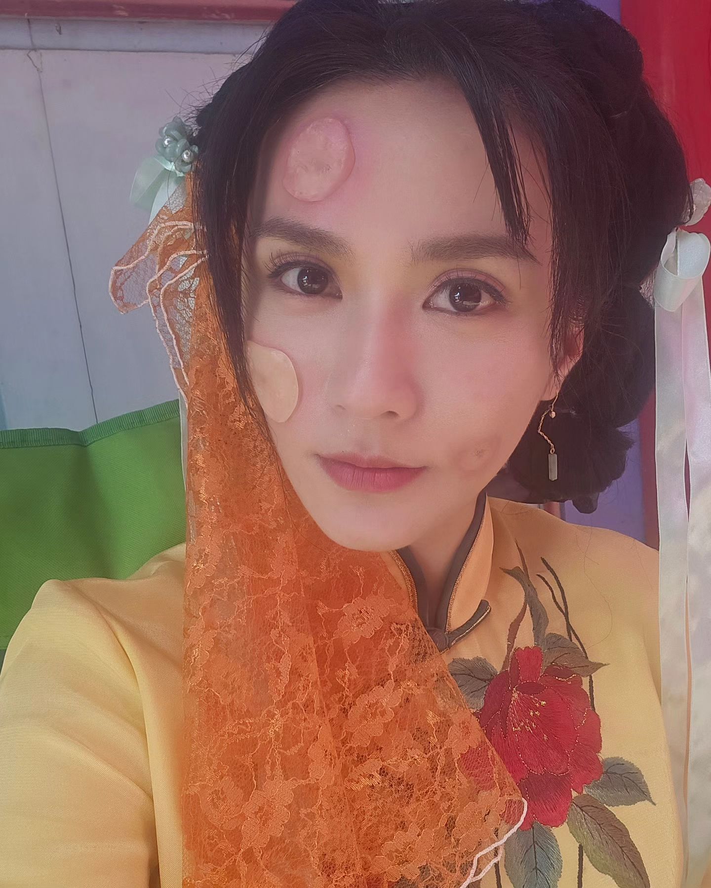 新劇今晚開播！38歲本土女星「驚現容貌怪怪的」大變形　認了「一天吃4顆」控制病情：為戲不開刀