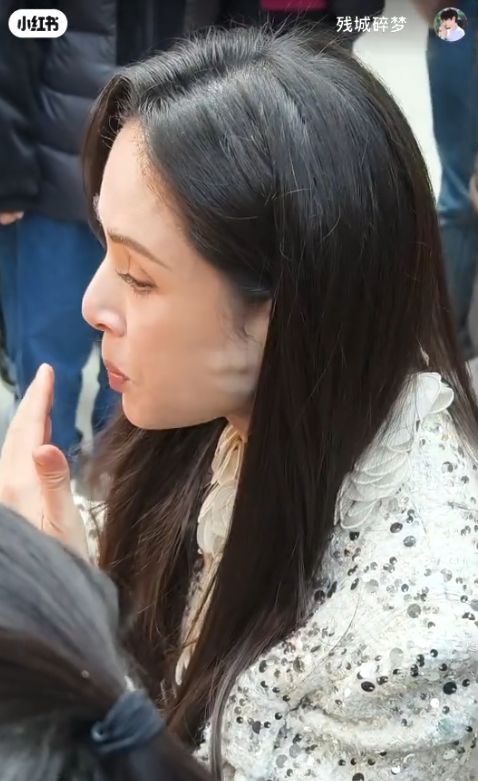 遭疑整型後遺症！57歲女神「臉頰出現詭異凸起」網酸：動過臉嗎　無奈揭真相「竟是怪病纏身」