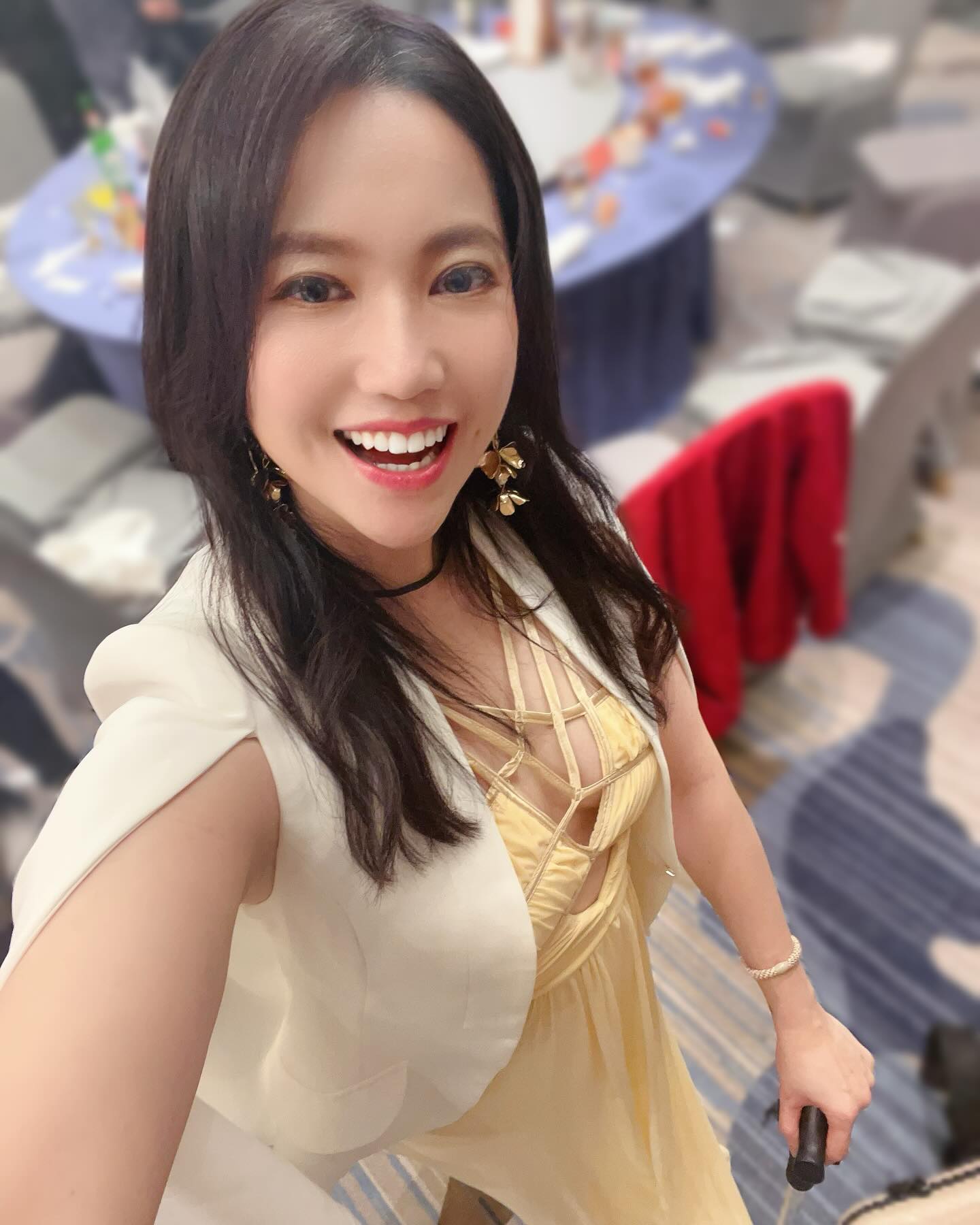 驚傳摔落舞台！44歲女星「2根骨頭斷裂」慘住院9天　拄拐杖露面「最新傷勢曝光」：都萎縮了...