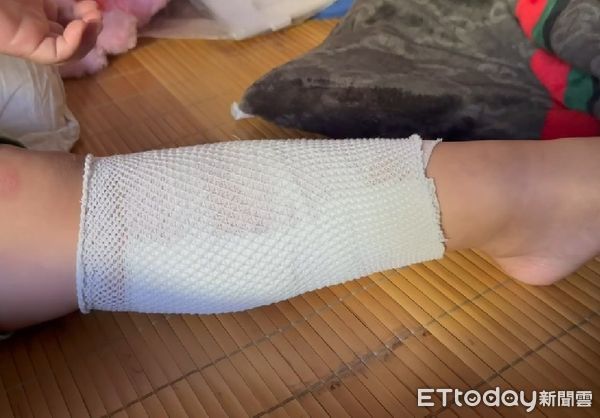 彰化國小3姊弟「走斑馬線遭撞飛」！妹插管急救「姐昏迷指數僅3」不樂觀　事發畫面曝光