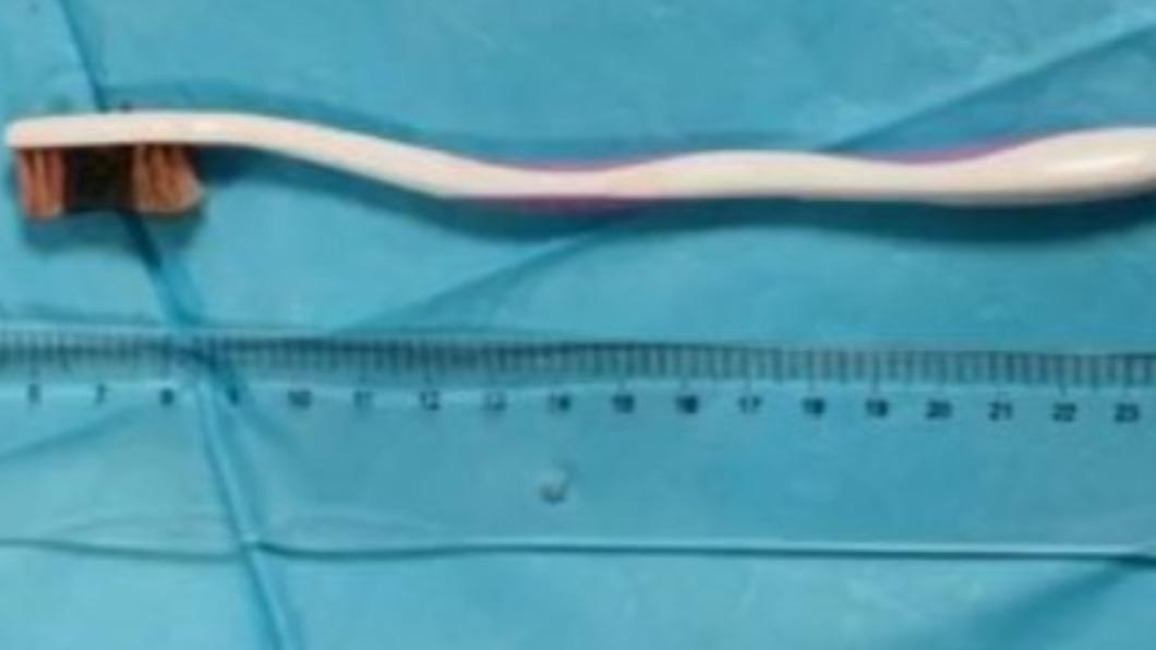 腹痛2天就醫！17歲少年檢查「驚見20公分棒狀物」　醫生傻眼：「怎麼吞下去的？」