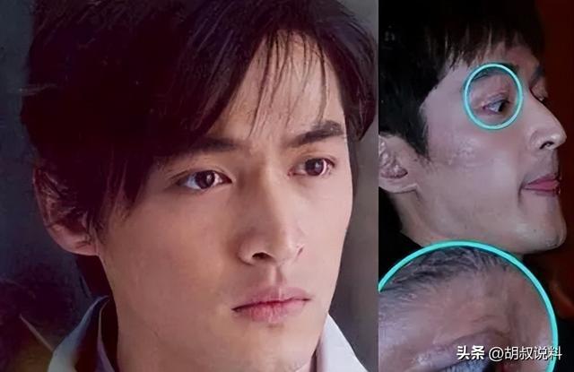 姐弟戀破局！戲劇小生車禍「女星不嫌棄守候」　分手後「她皈依佛門、他已成人夫」