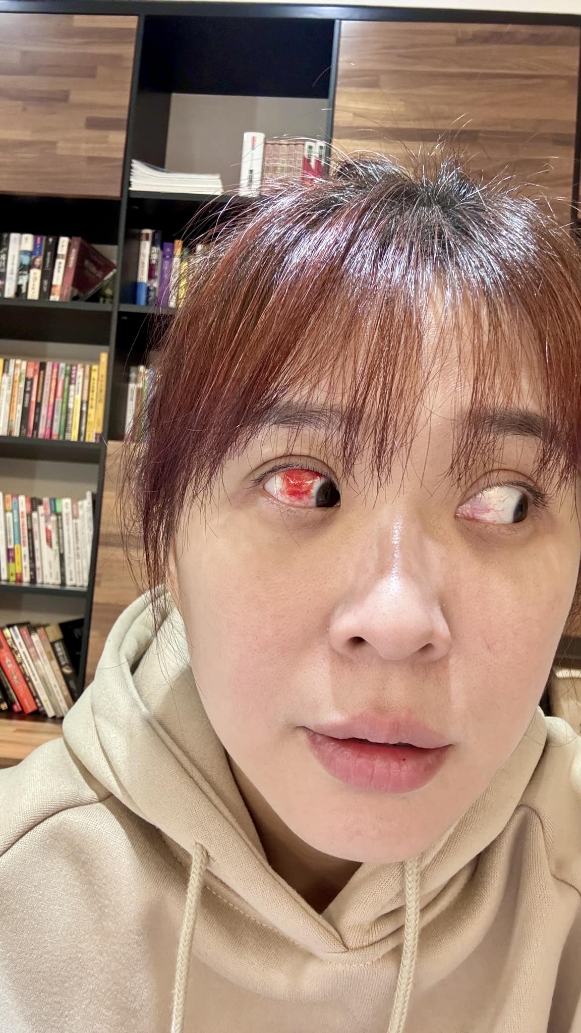 回台美照第一發！本土女神「曬超近自拍照」眼球爆血絲　苦嘆「殺紅了眼」症狀再加一：慘不忍睹