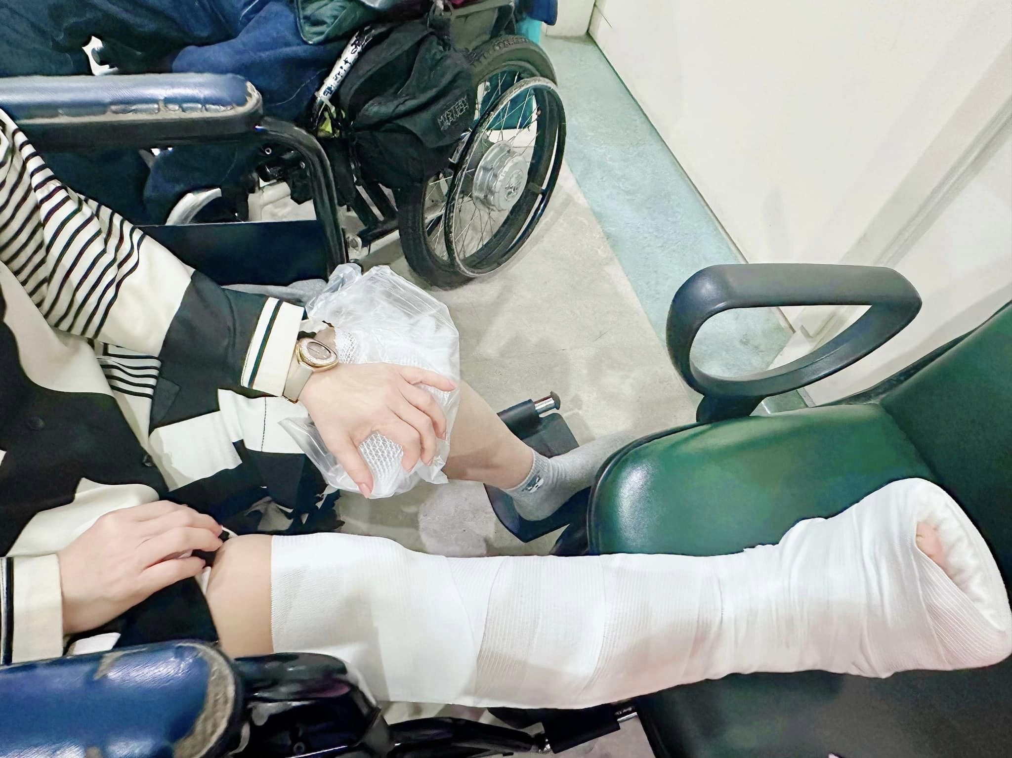 才剛打官司！64歲玉女歌手「驚傳摔斷腿」工作急喊卡　氣喊「會向市政府申訴」傷勢曝光
