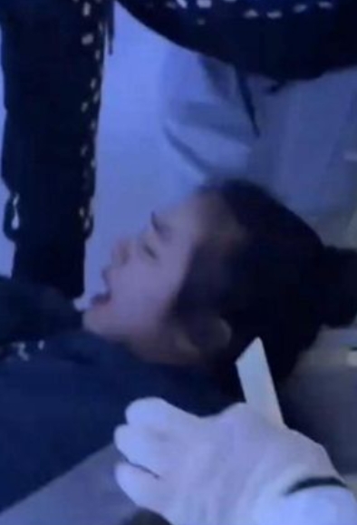 17歲學生「遭老師弄斷腿」舞蹈夢碎　對方冷回「只願賠22萬」：家屬太超過