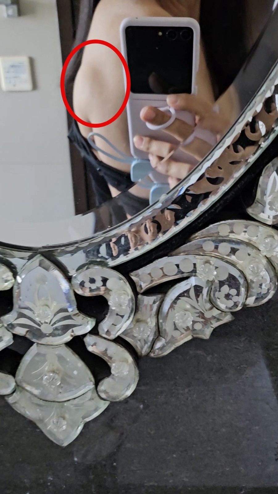 當媽才2年！41歲《戲說》女星「驚傳緊急動刀」　嚇壞「冒出6cm巨瘤」病況曝光