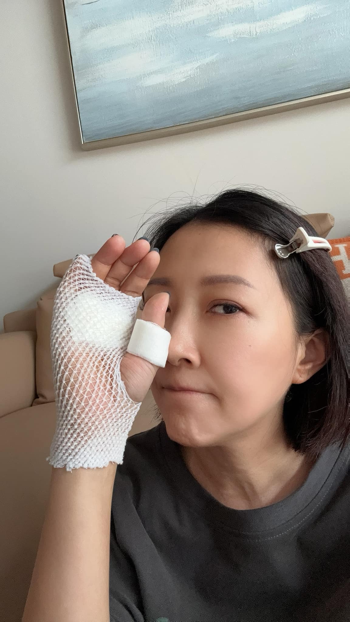 51歲余皓然「爆濺血意外」緊急送醫！公開最新傷勢「慘縫5針」原因曝光