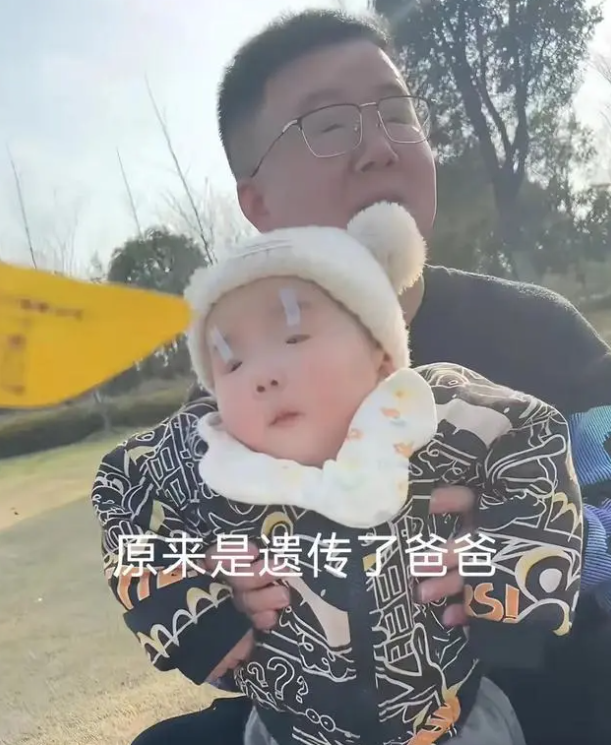 媽媽吐槽「兒子眼睛小」！網友一看笑不出來：別拖了，趕快帶去醫院...