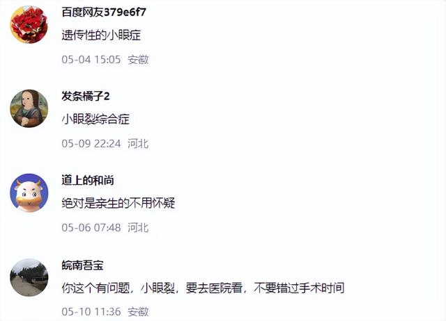 媽媽吐槽「兒子眼睛小」！網友一看笑不出來：別拖了，趕快帶去醫院...