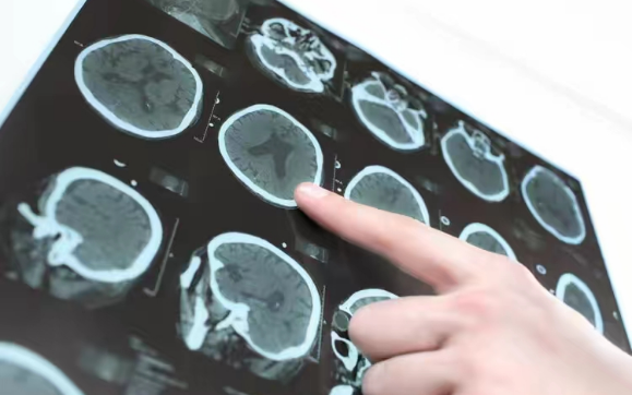 老年痴呆症的前兆！通常會說「3句口頭禪」　對照下「看你中幾條」及時檢查