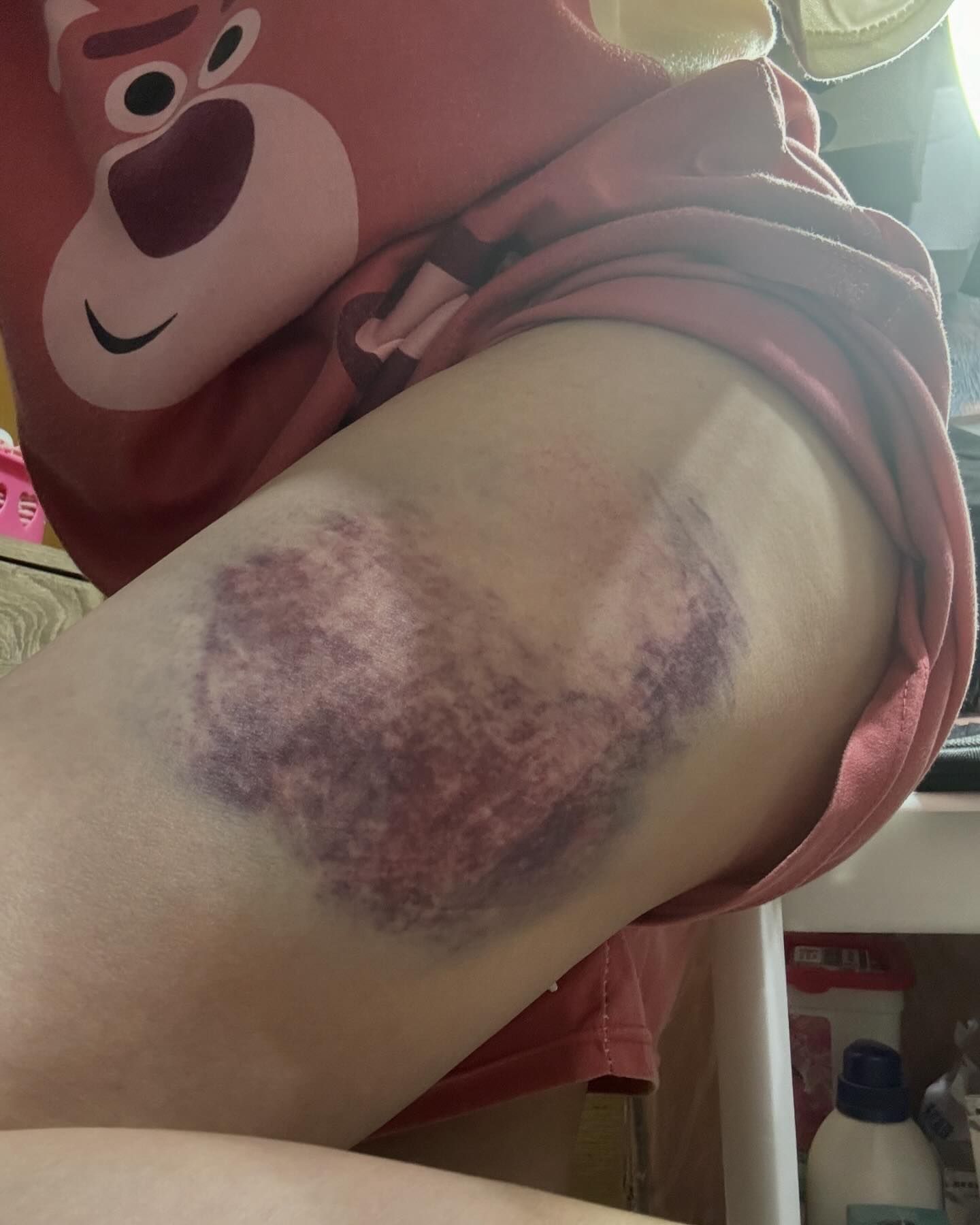 走在斑馬線上！43歲女星「遭汽車輾過」被壓車底　駕駛下車後「竟又倒車再輾」嚴重傷勢曝光