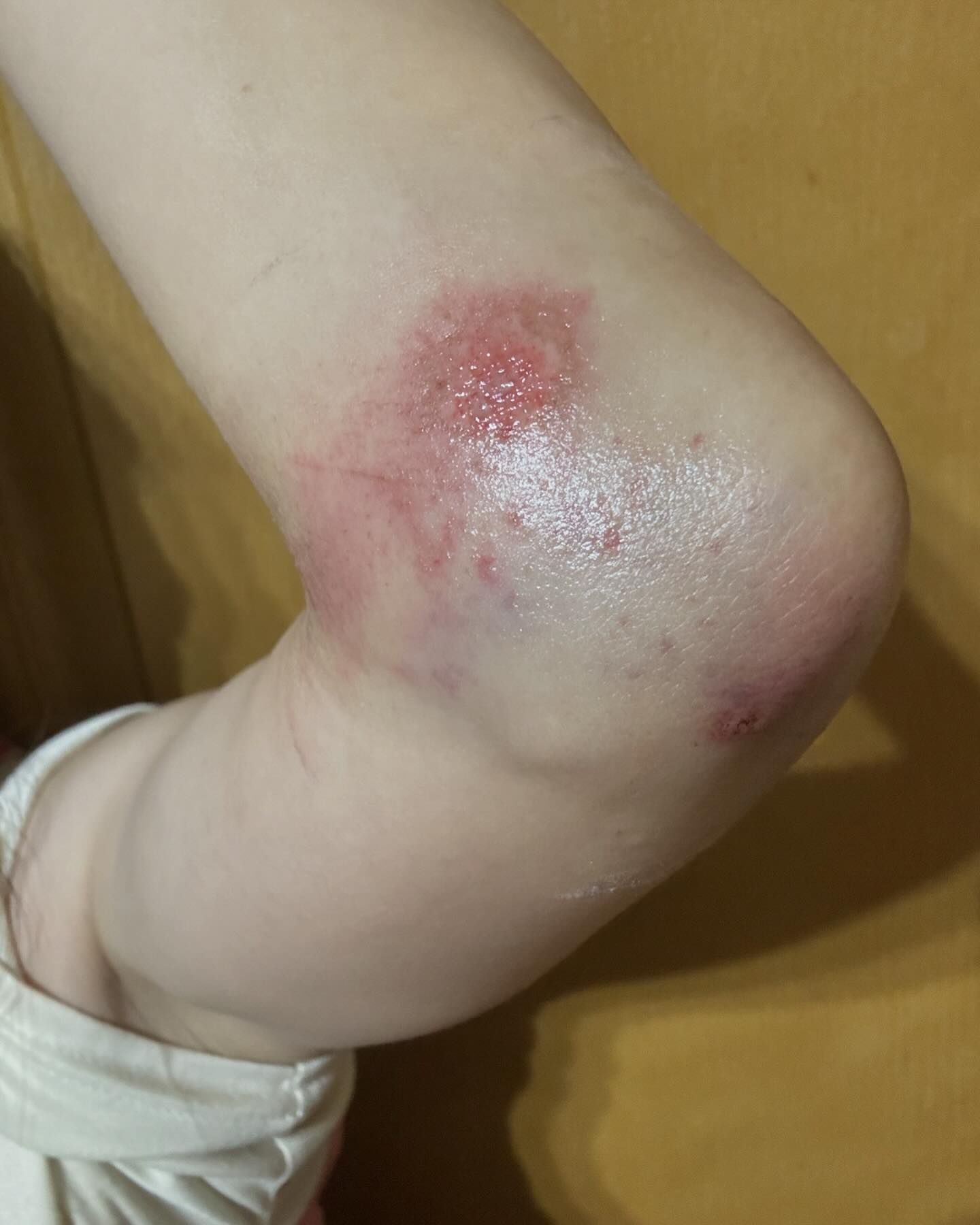 走在斑馬線上！43歲女星「遭汽車輾過」被壓車底　駕駛下車後「竟又倒車再輾」嚴重傷勢曝光