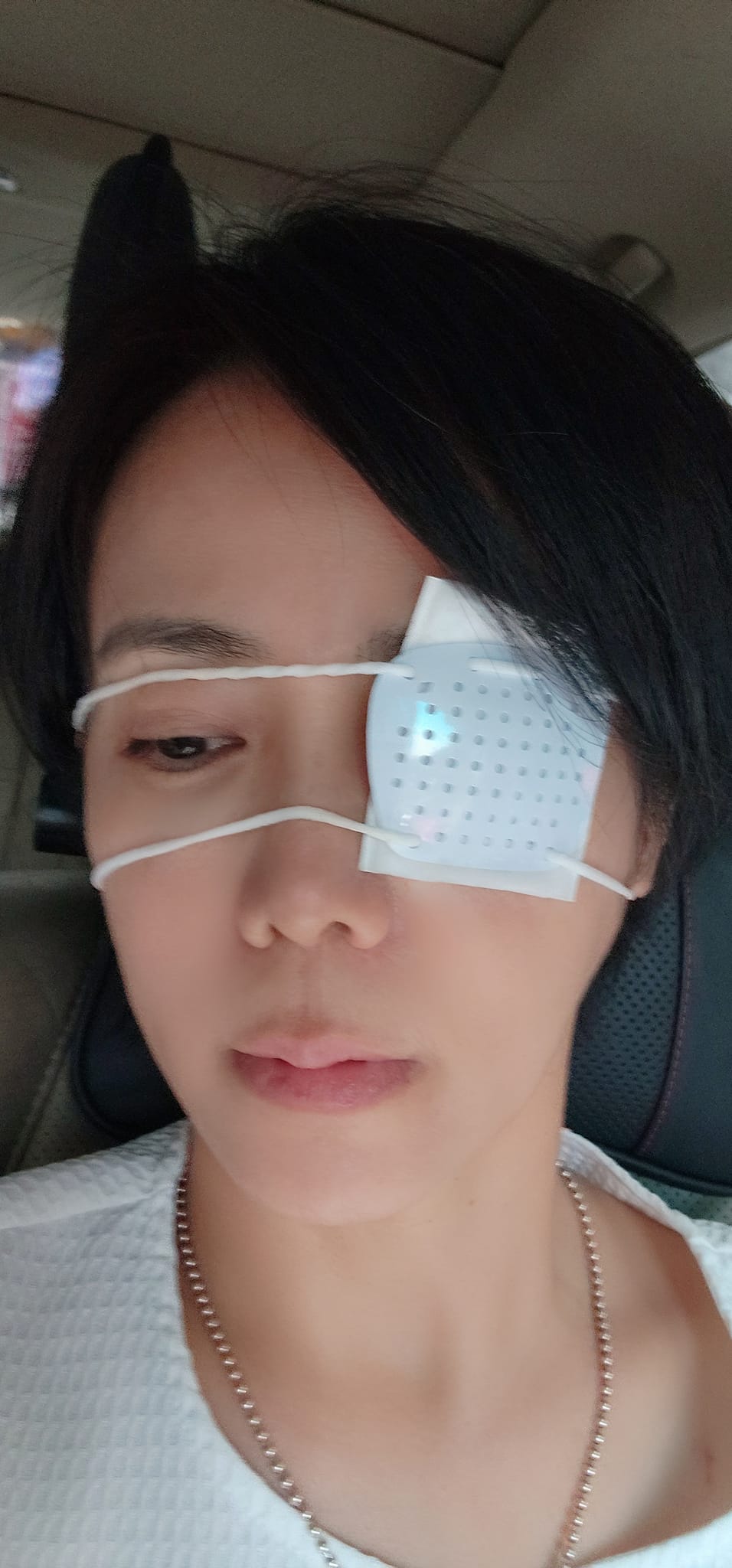 突然出事!50歲八點檔女星「變獨眼龍」傷勢嚴重 曝「罪魁禍首是家裡人」親揭老公反應