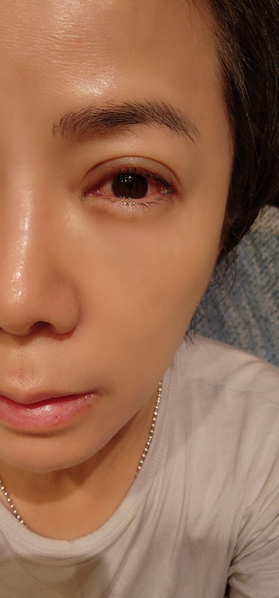 突然出事!50歲八點檔女星「變獨眼龍」傷勢嚴重 曝「罪魁禍首是家裡人」親揭老公反應