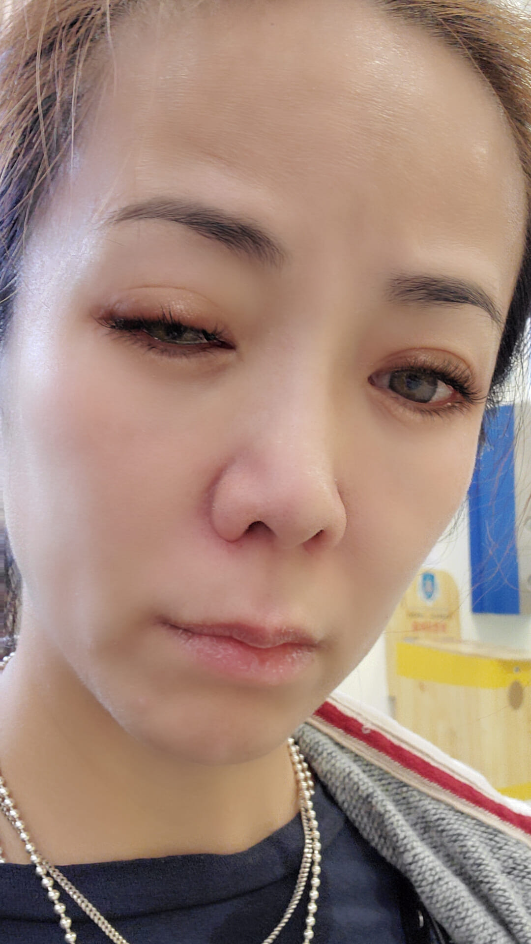 突然出事!50歲八點檔女星「變獨眼龍」傷勢嚴重 曝「罪魁禍首是家裡人」親揭老公反應