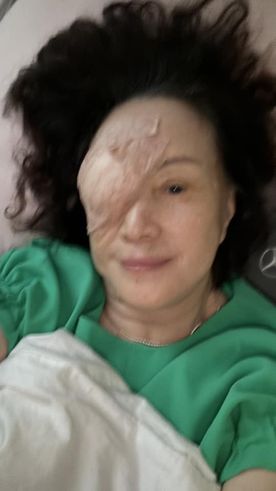 需要大家的祝福！78歲資深女星「入院動刀」：一個月開2次　曝術後畫面「親自報平安」