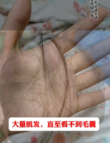 罹患癌症末期！抗癌大咖離世「生前近乎失明」　曾淚曝「還想活下去」母親崩潰：我哭著送妳...