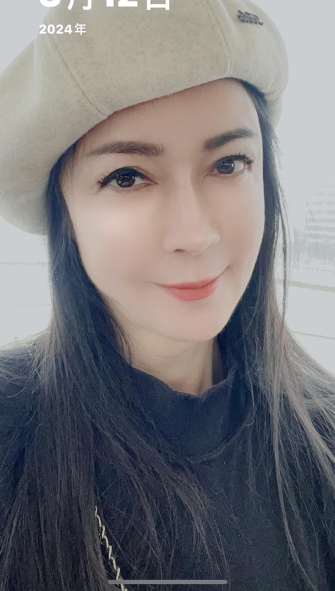 苦認面目全非！58歲女星「動手術六小時」拉三層皮　崩潰「遮全臉現身」嘆：已損失近百萬