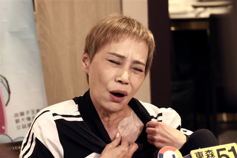 66歲歌后遭撞飛！送醫手術「劃開15公分」緊急停工　揭現況「一症狀纏身」嘆：沒好要再動刀