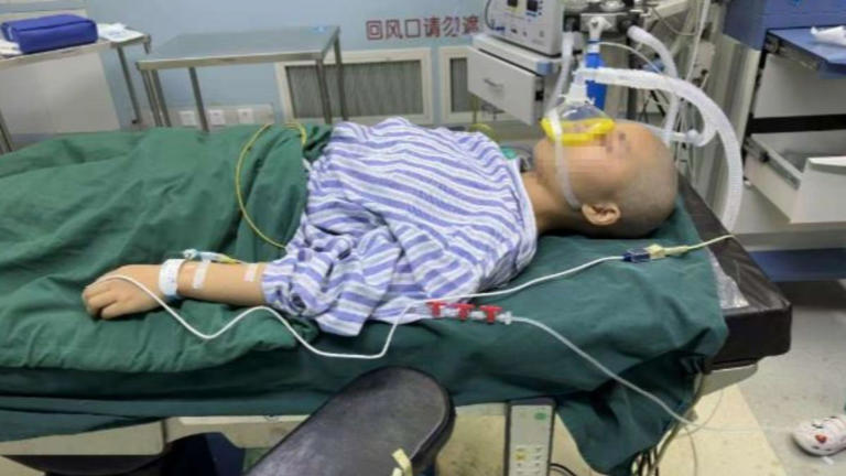 爸爸95％燒傷！22歲女剃髮「捐出全部頭皮」救父　躺病床「心痛發聲」網哽咽：孝女難得
