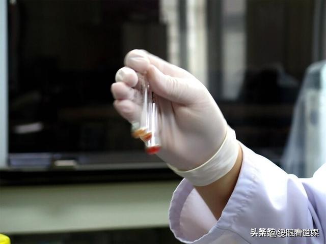 血型與癌症風險大揭秘！25年研究發現：這血型的人最幸運