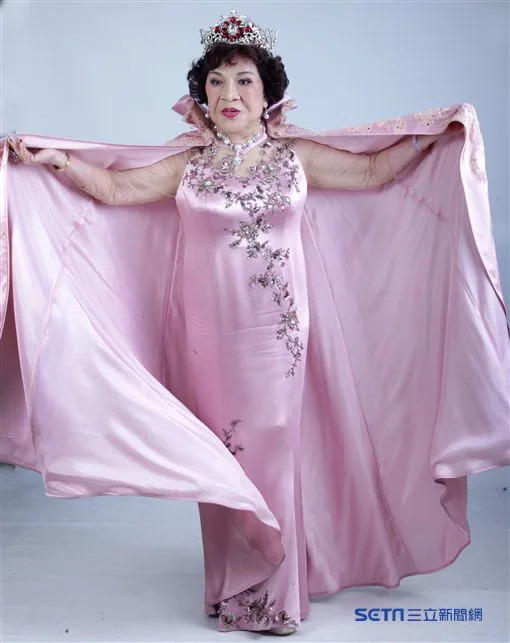 88歲阿姑驚傳「臉部動刀10小時」!最新病況曝光...