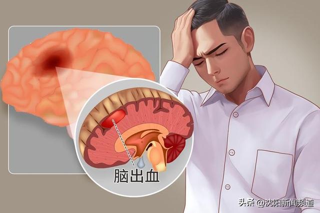 全台500萬人高血壓！「常吃兩種水果」風險降低40%　62歲阿姨「1習慣釀腦溢血」