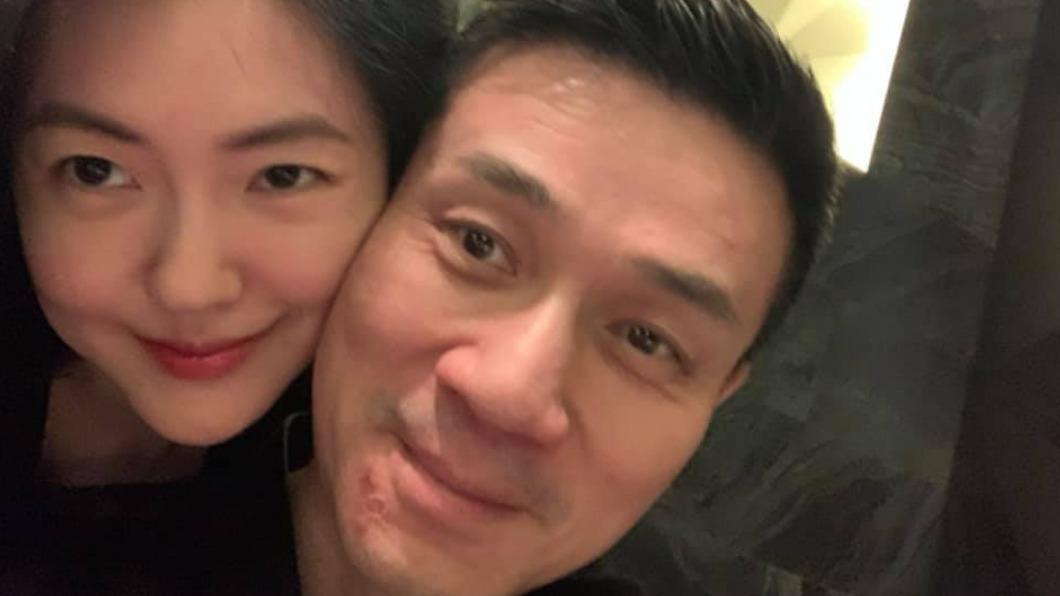 才拿下金鐘！47歲小S證實「健康亮紅燈」宣布人生重大決定　看健檢報告崩潰喊：「還能活到幾歲？」