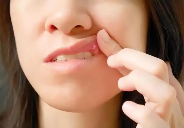 血糖超標警訊！口腔異常「3大信號」不可輕忽　糖尿病前兆早知道