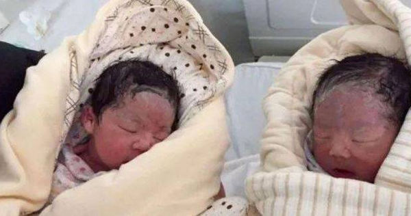 剖腹生龍鳳胎！孕婦縫合到一半「突喊等一下」　醫護「湊近一看驚呆」當場愣住：真是奇蹟