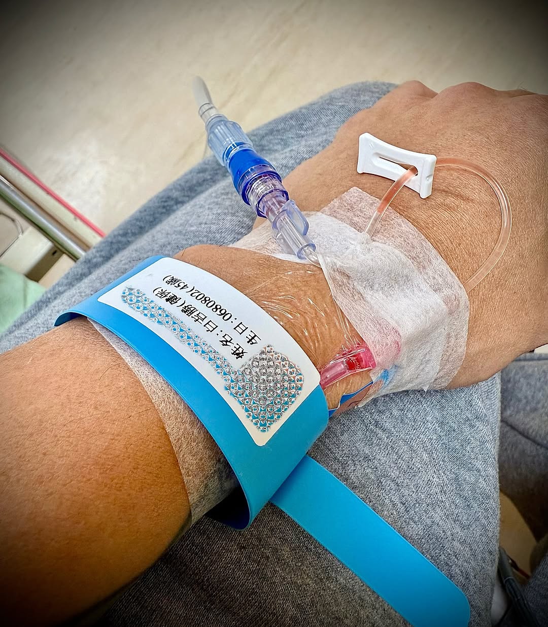 無預警住院動刀！46歲阿Ben「腹痛急診」認隱疾纏身　曬病榻照「取出5大顆」錯愕：塞滿了