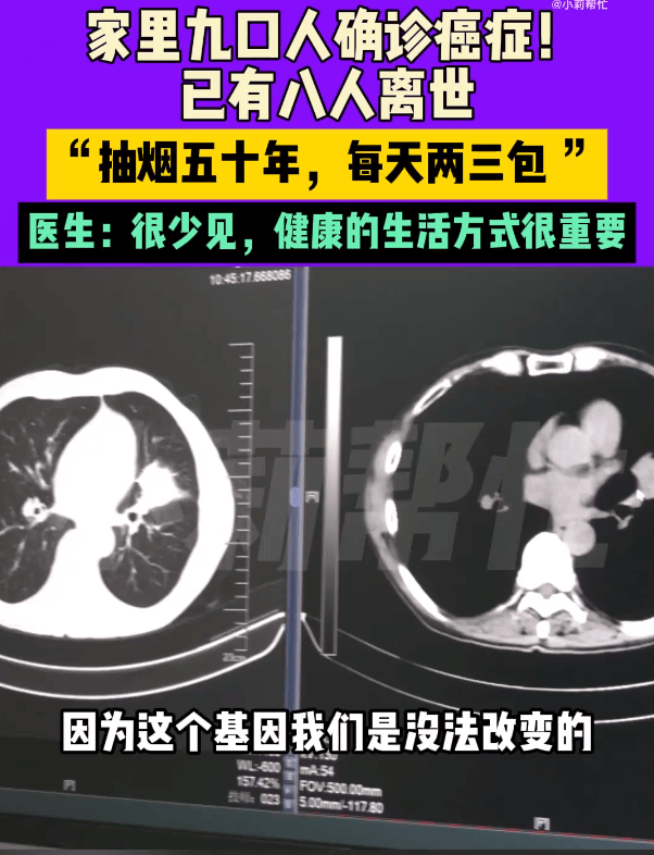 一家三代9人患癌!他悲吐「8人接連病逝」醫師嘆:很少見 揪出三大原因「提前發病年齡」