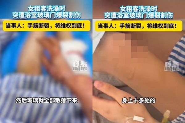才租半年！她剛洗完澡「玻璃門突然爆炸」當場見血　低頭一看「被割斷了」被緊急送醫
