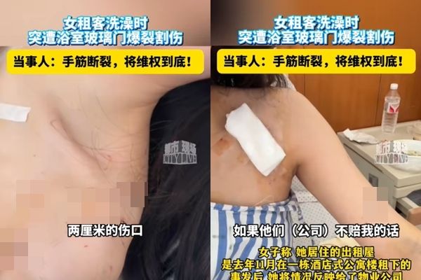 才租半年！她剛洗完澡「玻璃門突然爆炸」當場見血　低頭一看「被割斷了」被緊急送醫