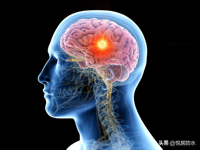 大咖巨星離世！享年58歲「腦癌奪命」粉絲悲慟　醫生曝「8種異常警訊」：一定別拖