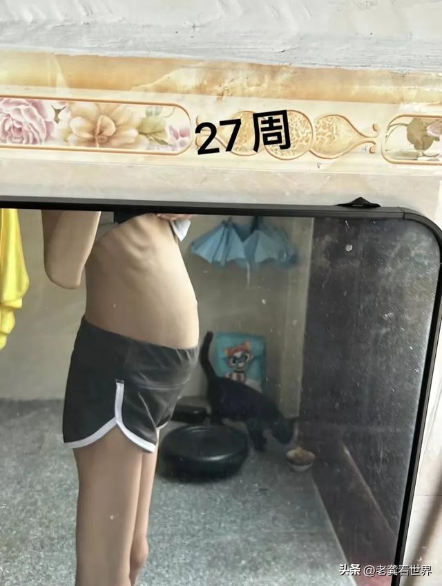 身高160公分！妙齡女體重「僅25公斤」還想繼續減肥　曾懷孕生子網嚇壞